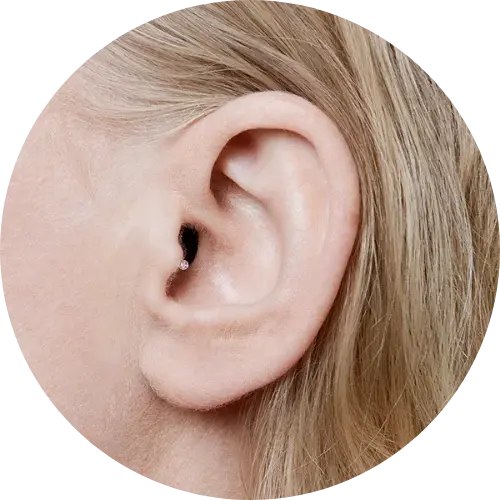 Invisible-in-the-canal (IIC) hearing aid